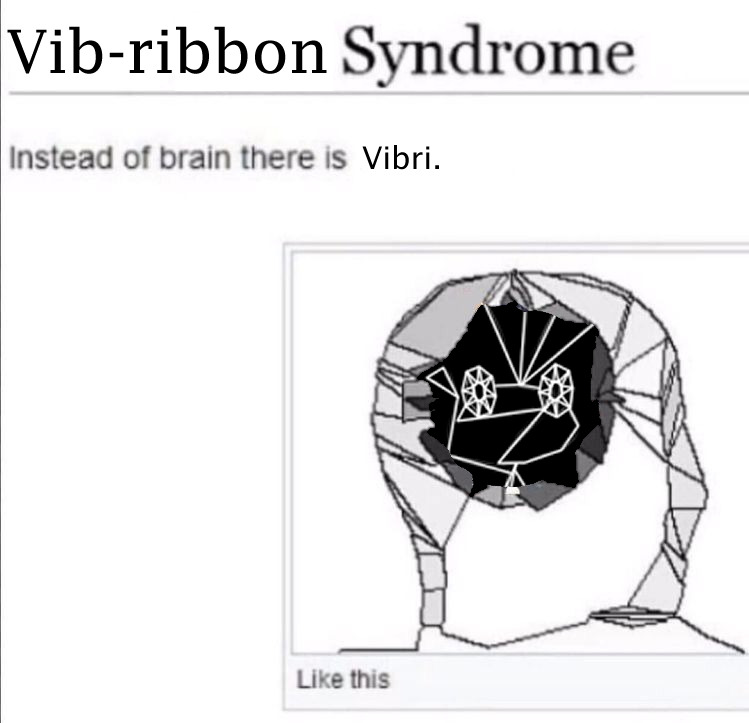 Vibri brain